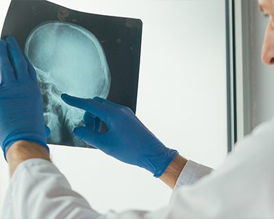traumatic brain injury law firm suffolk county ma traumatic brain injury law firm suffolk county ma